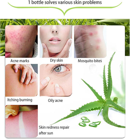 300X2 ML Gel D'Aloe Vera Naturel -Crème Hydratante Bio, Apaisante Et Hydratante, Réparatrice Coups De Soleil Et Cicatrices, Soin Visage Corps Cheveux